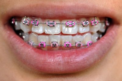 ortho2 ortho2