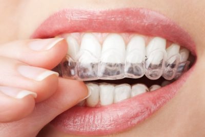 ortho3 ortho3