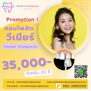 veneer composite 35000