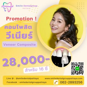 veneer composite 28000