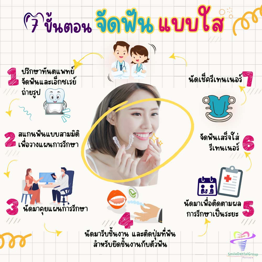 ขั้นตอนจัดฟันใส